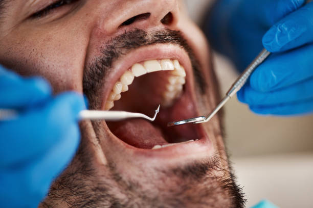 Best Knocked-Out Tooth Emergency  in Armona, CA